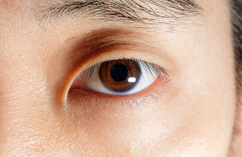 目元がはっきりしない